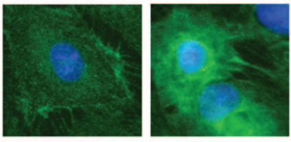 Placental ECFCs under immunofluorescence — endothelial markers in green, nuclei in blue